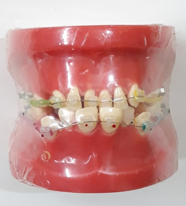  SYDEN ORTHO MODEL IN CERAMIC BRACKET WITH WIRE